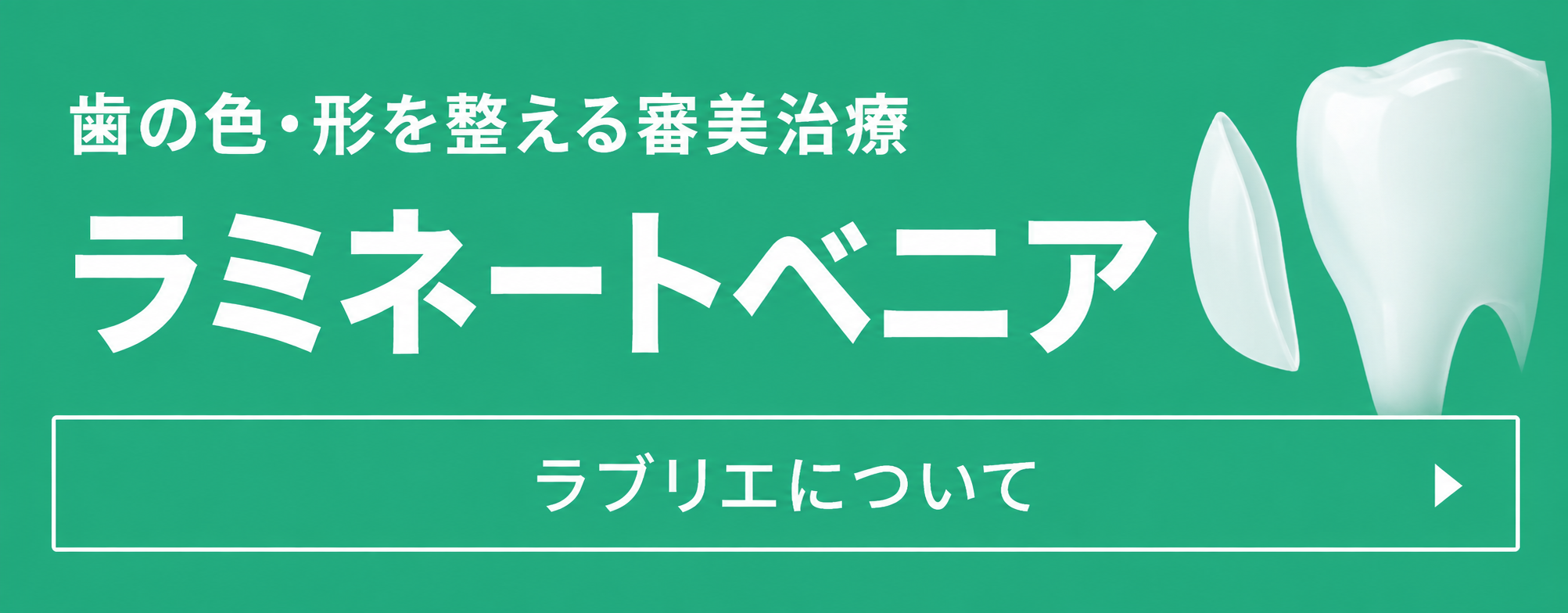 ラミネートベニア・ラブリエについて